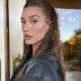 Hailey Bieber Akui Derita Kista Ovarium Berulang, Benarkah Bikin Sulit Hamil?