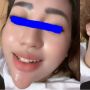 Punya Dagu Super Lancip, Perempuan Ini Malah Bikin Warganet Ngeri, Begini Sebabnya