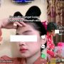 Bikin Sakit Hati! Menantu Ingin Usir Mertua Gegara Habiskan Makanan, Tuai Kecaman: Gatel Pengen Cepuin