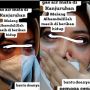 Viral, Video Perempuan dengan Mata Menghitam Dinarasikan Korban Gas Air Mata Kanjuruhan