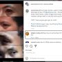 Kondisi Korban Selamat Tragedi Kanjuruhan Viral di IG, Mata Merah dan Sesak Nafas, Warganet: Marah Banget