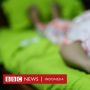 Gangguan Ginjal Akut Misterius Pada Ratusan Anak Masih Diteliti
