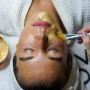 3 Manfaat Chemical Peeling bagi Kesehatan Wajah, Sayang untuk Dilewatkan!