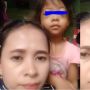 Ibu Curhat Mata Anak Bengkak Gegara Sering Main Hp, Warganet Curiga Ada Unsur Kekerasan