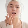 4 Cara Ampuh Merawat Bibir Pecah-Pecah, Terapkan Yuk!