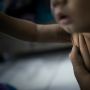 Warga Rusunawa Marunda Alami Gatal-gatal hingga Sakit Mata, Diduga Akibat Pencemaran Debu Batubara
