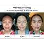 8 Transformasi Titi DJ yang Makin Awet Muda Usai Operasi Antiaging di Korea