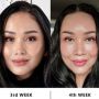 Titi DJ Dikabarkan Operasi Antiaging, Kenali Efek Samping dan Risikonya