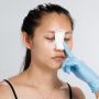 4 Jenis Operasi Hidung yang Enggak Cuma Bikin Mancung, Sudah Tahu Belum?