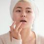 Bibir Kering saat Puasa? Lakukan 5 Cara Ini untuk Mengatasinya