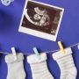 4 Rekomendasi Kado untuk Baby Shower, Berguna untuk Calon Ibu dan Bayi!