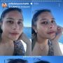 Prilly Latuconsina Tak Malu Tunjukan Freckles yang Hampir Penuhi Area Wajah, Penyebabnya Apa Ya?