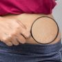 Cara Menghilangkan Stretch Mark, Lengkap dengan Rekomendasi Produk
