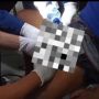 Pria Ditolong Petugas Damkar Gegara Cincin Nyangkut di Mr P: Meleset Dikit Si Joni Kelar!