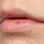 Bibir Kering Bikin Anda Tidak Percaya Diri? Coba Terapkan 6 Tips Berikut