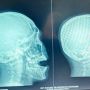 Ratusan Calon Dokter di Kota Makassar Dianiaya Dalam Ruangan Gelap, 3 Orang Luka Parah
