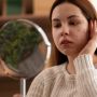 6 Tips Memilih Krim Penghilang Bekas Jerawat, Jangan Sembarangan Beli Produk Viral
