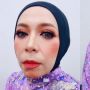 Penampilan Melly Goeslaw dengan Pipi Tirus Bikin Kaget, Netizen Sebut Mirip Aming