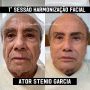 Viral Wajah Aktor Brasil Stenio Garcia yang Berusia 91, Jadi Tampak Lebih Muda 15 Tahun