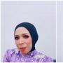 Penampilan Disorot, Ini Dua Operasi yang Pernah Dijalani Melly Goeslaw