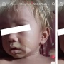 Duh! Ibu Nekat Bleaching Rambut Bayi 14 Bulan dan Ngotot Sudah BPOM, Netter Pusing: Gak Tertolong