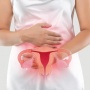 Hati-Hati! Inilah 6 Penyebab Terjadinya Adenomiosis bagi Rahim Wanita