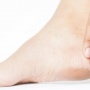 4 Tips Mudah Mengatasi Kulit Kaki yang Kering dan Kasar, Pernah Mencobanya?