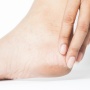 5 Solusi Atasi Kulit Kaki Pecah-pecah, Perawatan Simpel Langsung Mulus!
