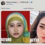 Foto Jadul Luluk Nuril Beredar, Perubahan Dagu dan Alis Bikin Salfok: Semua Akan Cantik Kalau Ada Uangnya
