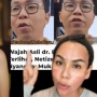 Bela dr Richard Lee, Melaney Ricardo Ungkap Wajah Aslinya: Bopeng Bukan Aib