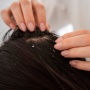 4 Sinyal Tubuh Kekurangan Nutrisi Penting, Perhatikan Kondisi Rambutmu!