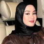 Efek Pakai Behel, Wajah Dinda Hauw Ramai Disebut Mirip Siti Atikoh
