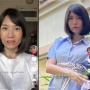 Niatnya Tampil Cantik Eh Malah Tertimpa Apes, Wanita Ini Ceritakan Kisahnya yang Gagal Botox