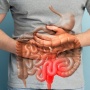Revolusi Pengobatan Tumor Pencernaan: EUS-RFA, Harapan Baru Tanpa Sayatan Besar