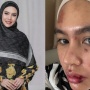 Kartika Putri Merasa Miris Sekaligus Tertawa Baca Komentar Julid Netizen Soal Penyakitnya