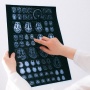 Apa Itu Empty Sella Syndrome? Mengenal Gejala Penyakit yang Diderita Ruben Onsu
