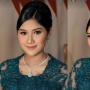 Sedang Hamil Datang ke Acara Ngunduh Mantu Beby Tsabina, Erina Gudono Pakai Sandal Mewah