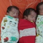Hamil Bayi Kembar? Waspada Preeklamsia hingga Kelahiran Prematur!
