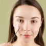Jerawat Auto Kering! 3 Acne Spot Mengandung Sulfur Harga Mulai Rp5 Ribu