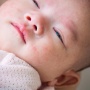Biang Keringat Bayi Bisa Jadi Kondisi Serius, Begini Cara Mengatasinya Mom!