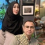Berapa Biaya Prosedur Facelift? Dilakukan Amy Qanita Ibunda Raffi Ahmad
