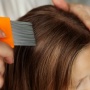 7 Cara Menghilangkan Telur Kutu Rambut sampai Bersih, Bye-Bye Kulit Kepala Gatal!