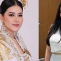 Beda Jauh Circle Kahiyang Ayu dan Clara Wirianda, Perempuan yang Dituding Dekat dengan Bobby Nasution