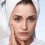4 Acne Patch Terbaik untuk Angkut Jerawat, Bebas Bekas!
