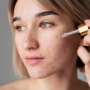 3 Rekomendasi Calming Serum, Solusi Ampuh Meredakan Kulit Kemerahan