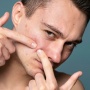 4 Rekomendasi Acne Spot Treatment yang Ampuh Hempas Jerawat Membandel