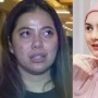 4 Fakta Dokter Kamelia Pacar Ammar Zoni: Pernah Berjilbab, Beda dengan Irish Bella yang Berhijab Usai Hijrah!