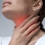 Sakit Tenggorokan Lebih dari 3 Minggu Pertanda Gejala Kanker? Ini Penjelasan Dokter