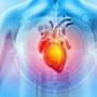 Mengenal Zero Fluoroscopy, Pilihan Baru Tindakan Jantung