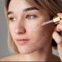 4 Brightening Serum yang Viral di TikTok Efektif Pudarkan Bekas Jerawat
